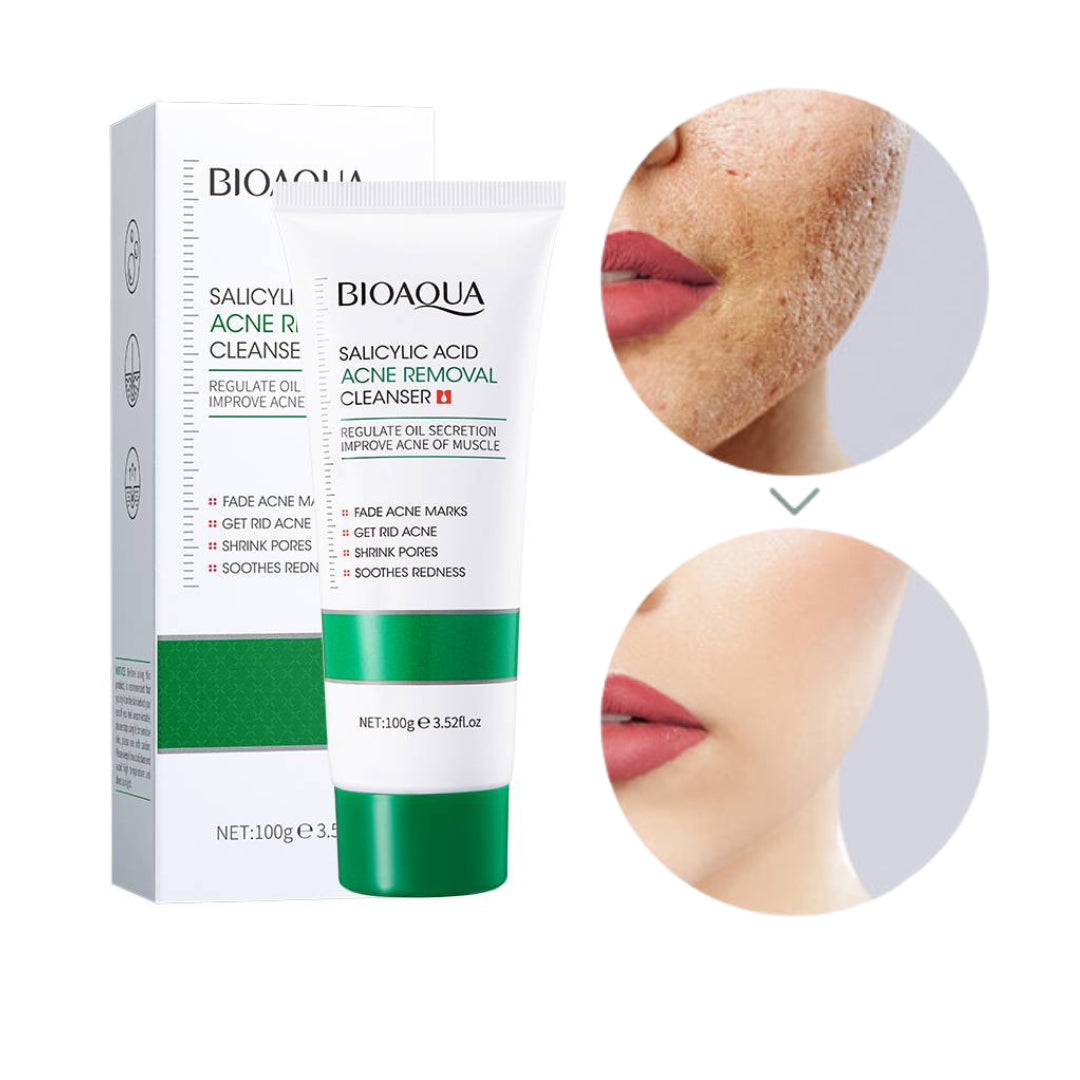 Jabon antiacné acido Salicilico - Bioaqua